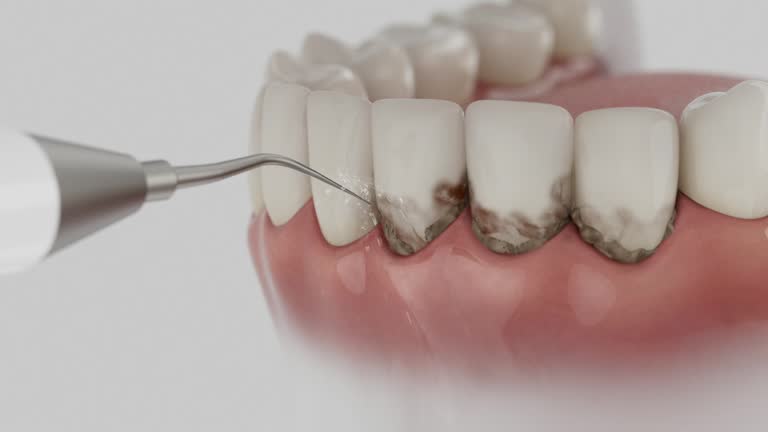 Reliable Wisdom Tooth Removal contractor in Franklin County County, AL by Dentist Open Now